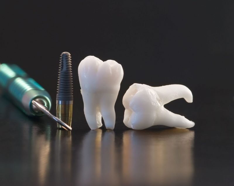 Minimally Invasive Options